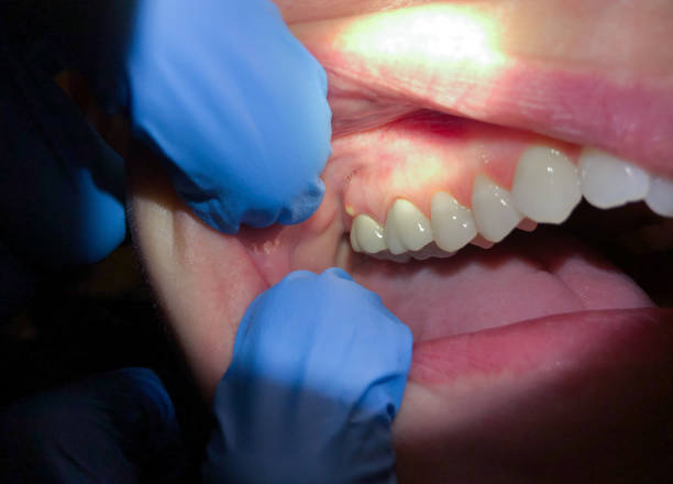 Best Weekend Emergency Dental Services in Halstead, KS
