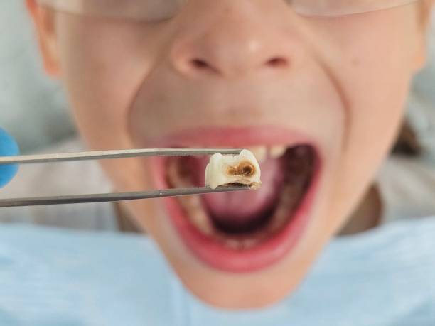 Best 24-Hour Emergency Dental Care in Halstead, KS